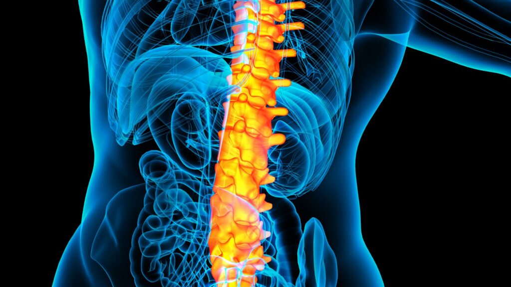 Outpatient Spine Surgery
