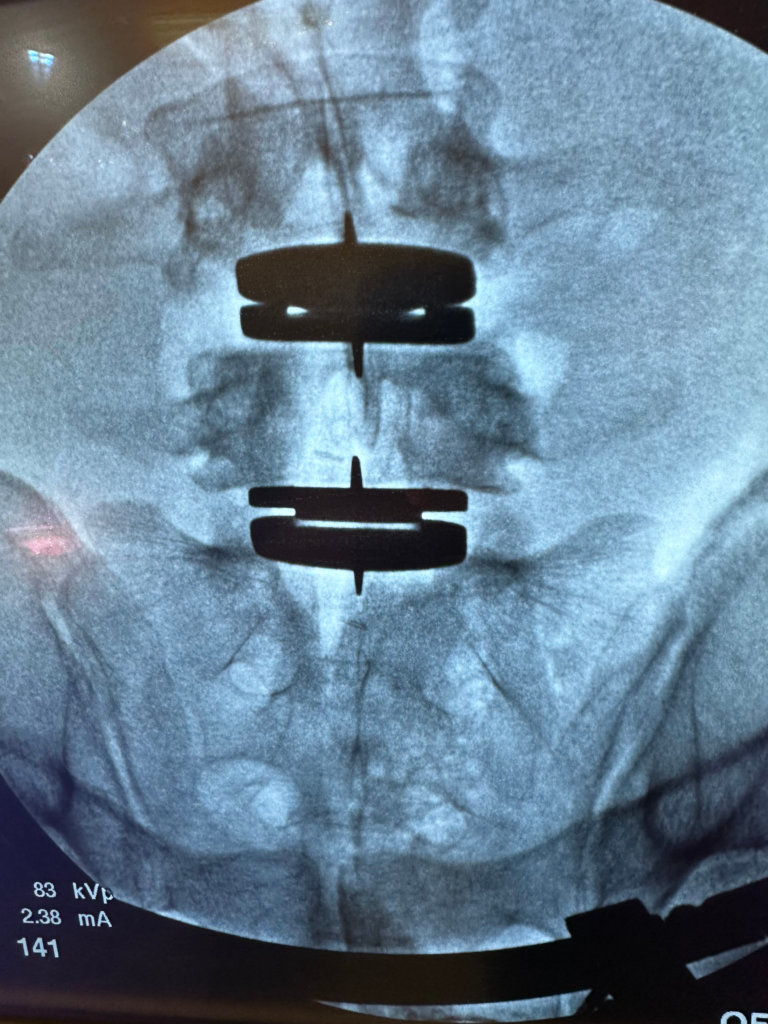 IMG_20251129_112558_(1)